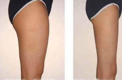 無錫整形醫(yī)院綜合實力高居榜首，口碑票選TOP10，搶眼亮相！