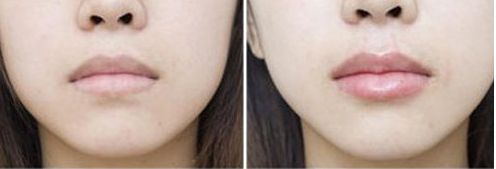 西安祛斑好醫(yī)院是哪家醫(yī)院？綜合用戶評價，哪家西安祛斑醫(yī)院效果好？