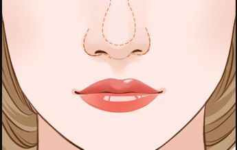 廣州治療疤痕最好的醫(yī)院有哪些？