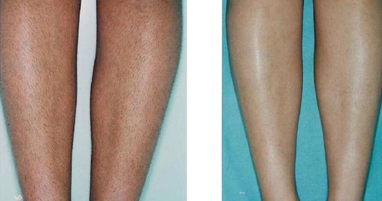 廣州鼻子整容哪家醫(yī)院口碑好，效果最佳？