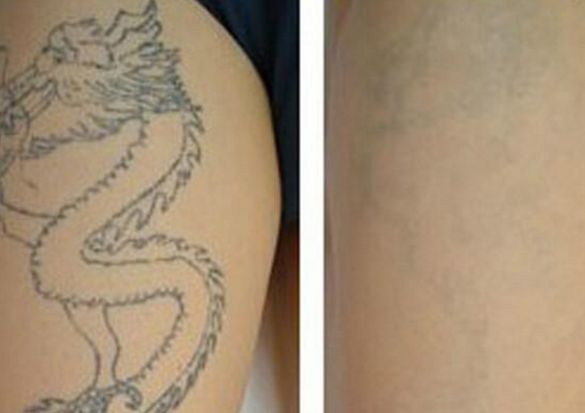 佛山面部吸脂醫(yī)院排名及評測，哪家最受用戶信賴？