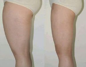 葫蘆島整形醫(yī)院排名如何？哪家好？