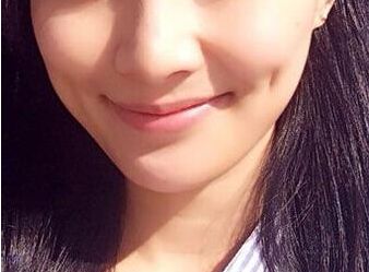 常州市整容醫(yī)院哪家好？選個(gè)專業(yè)的，專注于整容美容多年的醫(yī)院吧！