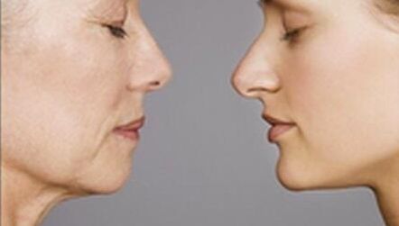 廣州整形醫(yī)院推薦：吸脂術(shù)技術(shù)高超，好評如潮