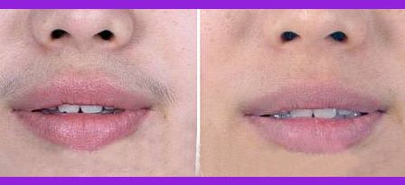 南昌哪家美容整形醫(yī)院效果好？