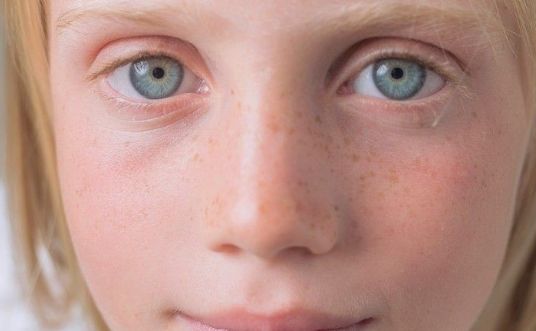 鄭州市哪家眼皮整形醫(yī)院口碑不錯？讓你眼前一亮的推薦！