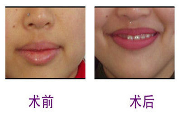 上海東方醫(yī)院是一家醫(yī)美整形的專業(yè)機構(gòu)嗎？他們的簡介如何？