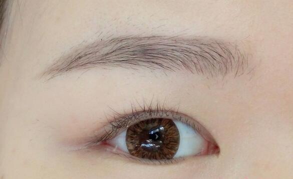 面部筋膜懸吊真的能讓人年輕嗎？或許會有哪些潛在風險呢？