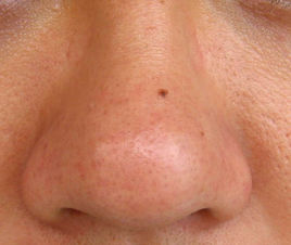 無錫哪家醫(yī)療美容醫(yī)院口碑好？2023年矯正乳頭肥大選擇這10家值得信賴的美容醫(yī)院！