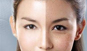 威海哪家醫(yī)院去疤痕好？專家推薦的治療疤痕的威海醫(yī)院有哪些？