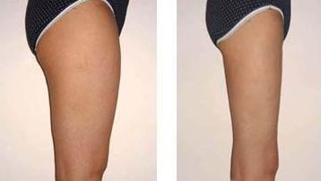 常州做美容哪家好？專業(yè)人員告訴你最受歡迎的美容院