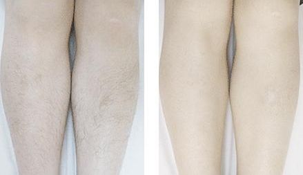 浙江哪家整形醫(yī)院可靠，不錯(cuò)的做隆胸效果好