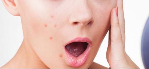 2023年成都才做疤痕治療的醫(yī)院：恢復(fù)肌膚亮麗