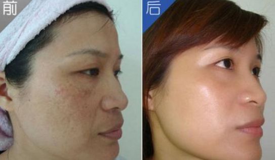 哪個常州醫(yī)院?？浦委煱毯坌Ч?？