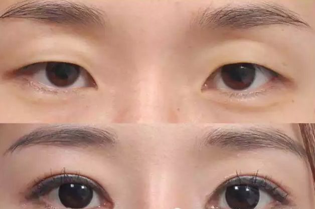 哪家醫(yī)院是唐山首選彩光點(diǎn)陣激光整形醫(yī)院2023唐山整形醫(yī)院行業(yè)迎來新變革！