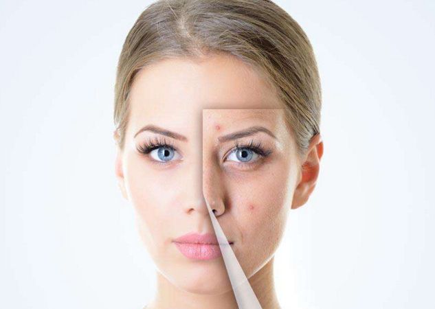 邯鄲哪家祛痘的效果好？比較邯鄲各大祛痘機(jī)構(gòu)的綜合實(shí)力和用戶口碑！