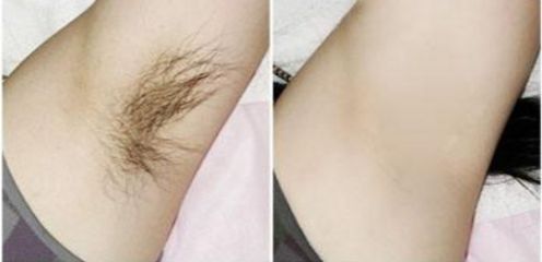 北京減肥好醫(yī)院排名推薦，哪家北京減肥的好醫(yī)院口碑最好