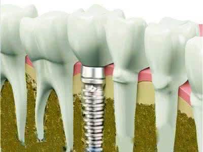 黑臉娃娃使用是否安全？使用前要注意的事項都有哪些？