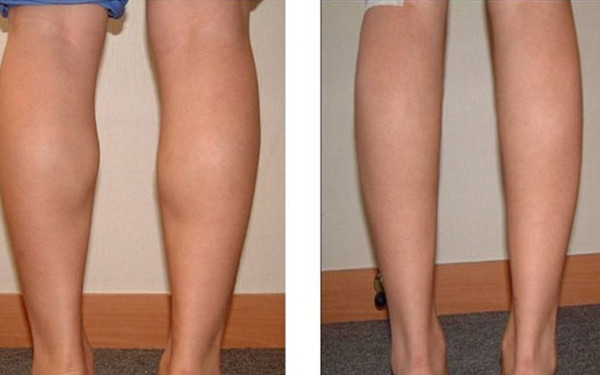 高曉松的健康秘訣是什么？他竟然在26天內(nèi)減去了26斤體重？