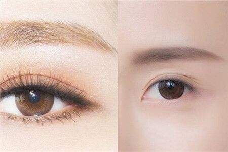 如何有效縮小鼻翼尺寸？讓你不再為寬鼻煩惱！