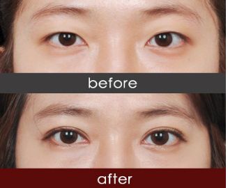 寧波市最佳美容醫(yī)院排行榜：寧波市美容醫(yī)院哪家好？