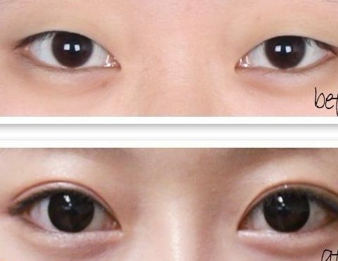 曙光醫(yī)院奪得桂冠，解密廣州的高級整容技術(shù)！