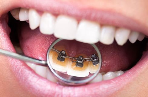 重慶顳部膨體填充排名前10整形醫(yī)院盤點(diǎn)，美麗改造特色揭秘