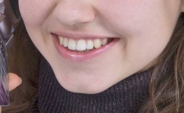 合肥市哪家醫(yī)院治療疤痕好？專家推薦的治疤痕醫(yī)院有哪些？