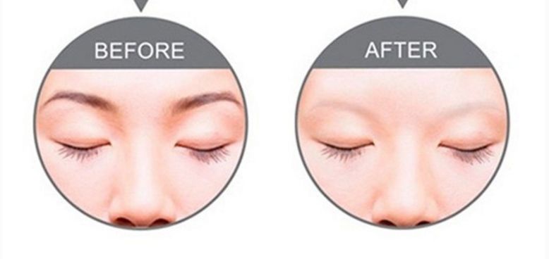 深圳正頜手術(shù)哪家醫(yī)院好？專(zhuān)業(yè)醫(yī)院推薦及患者評(píng)價(jià)