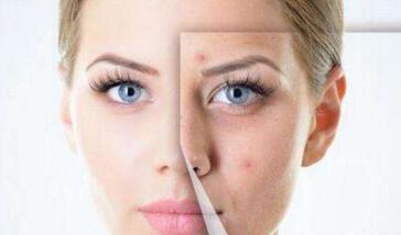 熱瑪吉五代的功效與副作用真實(shí)可信嗎？