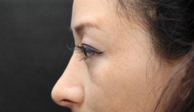 南京腮幫子削骨手術排名榜單出爐！TOP10醫(yī)院推薦！