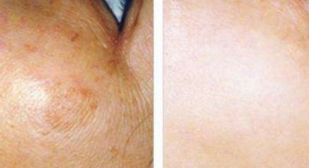 揭秘魯豫是否經(jīng)歷了整容手術(shù)：探尋真相之路