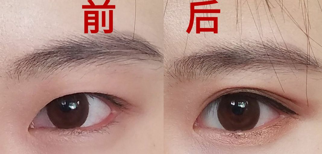 蘇州祛痘印醫(yī)院哪家好？專家推薦的頂級祛痘印醫(yī)療機構(gòu)有哪些？