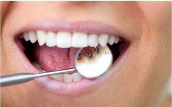 廣州哪些醫(yī)院治療法令紋效果好？2023年排名前10的醫(yī)院大比拼！