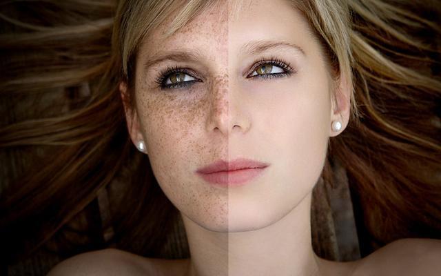 2023年哪家醫(yī)院在南通超聲刀去木偶紋整形排行榜前十名？網友眾說紛紜贊好！