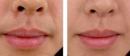 合肥醫(yī)療美容醫(yī)院哪家好？揭秘合肥頂級(jí)醫(yī)療美容機(jī)構(gòu)