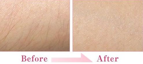 蘇州有哪些可以去疤痕的醫(yī)院？