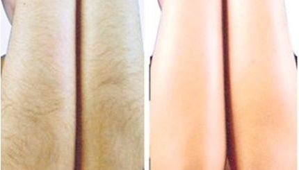 南充整形好醫(yī)院是哪家？專家點(diǎn)評南充地區(qū)整形美容醫(yī)院排名