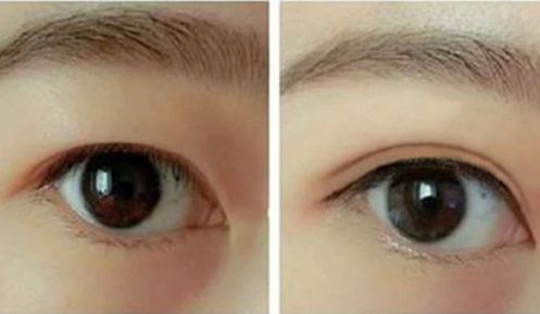 蚌埠去胎記哪家醫(yī)院好？專業(yè)醫(yī)生推薦蚌埠市頂級(jí)醫(yī)療機(jī)構(gòu)排行榜