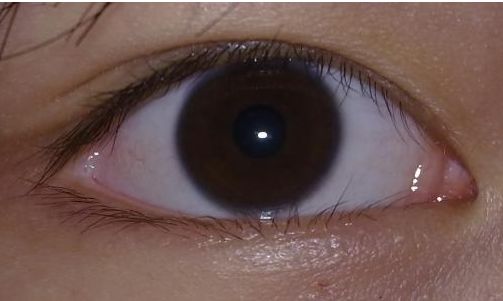 2023深圳鼻部與眼部整形專家將帶來驚艷的變化！