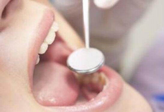 2023年青島祛口周紋手術(shù)醫(yī)院綜合TOP10排行，經(jīng)驗豐富的醫(yī)院大揭秘！