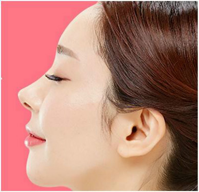 激光脫腋毛有哪些優(yōu)點(diǎn)好處？夜來(lái)香和脫腋毛有關(guān)系嗎？