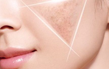 揭秘：過去的港風(fēng)美人整容了嗎？深入探討翻拍劇中的美貌之謎