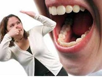 東莞市腋臭治療哪家醫(yī)院技術(shù)好且口碑好