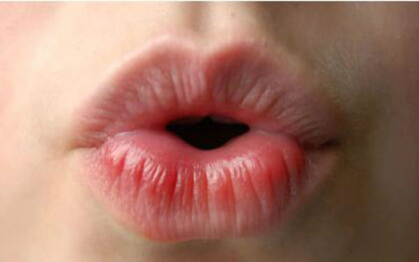 昆明肉毒素注射哪里好？2023年昆明整形醫(yī)院進(jìn)口肉毒素排行TOP10出爐！