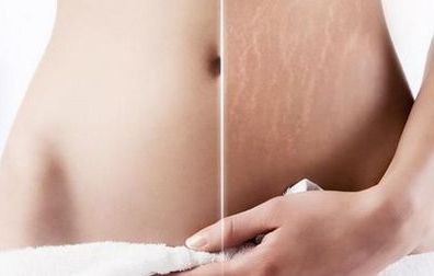 南寧做鼻子哪家整形醫(yī)院好？權威測評告訴你最靠譜的選擇