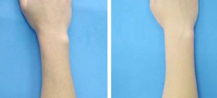 全國(guó)著名植發(fā)機(jī)構(gòu)集錦：北京、蘇州、成都三家翹楚