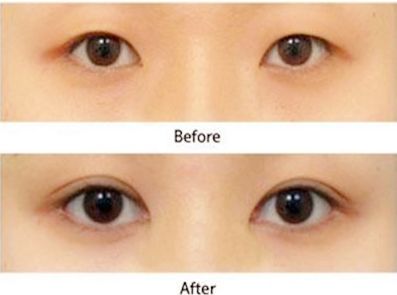 合肥整形哪家醫(yī)院排名好，專家告訴你如何選擇合肥整形醫(yī)院