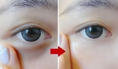 上海哪家醫(yī)院的雙眼手術(shù)效果最好呢？