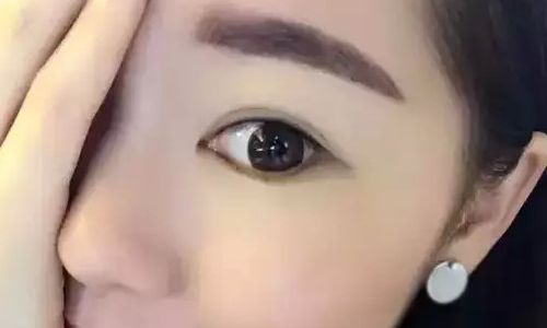 杭州哪家做隆鼻好？年度網友推薦：美萊、薇琳、時光等！